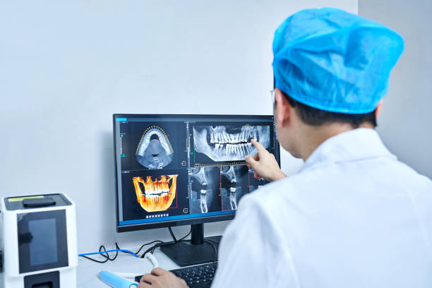 Best Emergency Wisdom Teeth Removal in Standish, MI